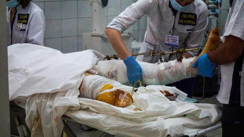 REPORTÁŽ z ukrajinské nemocnice: Utržené končetiny, léčba pečením i český autobus